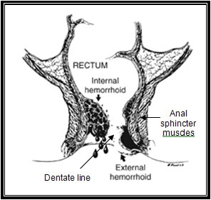 Hemmorroid anatomy